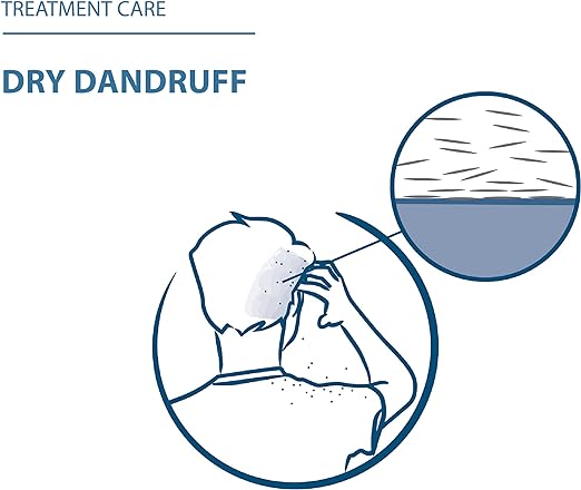 SQUANORM ANTI DANDRUFF 200ML - Shop N Save